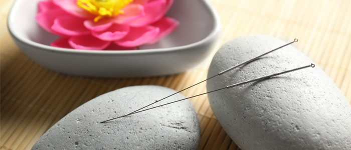acupuncture needles resting on stones